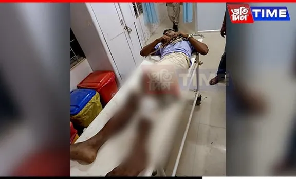 Assam: Dacoit Injured in Police Firing While Attempting to Escape Custody